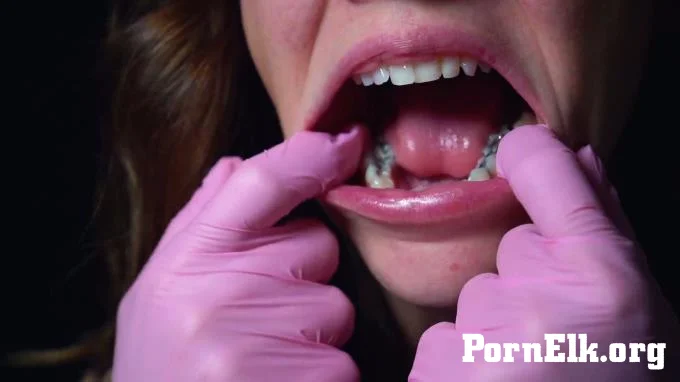 Destines Dungeon - 10 Minute Silver Fillings  [FullHD 1080]